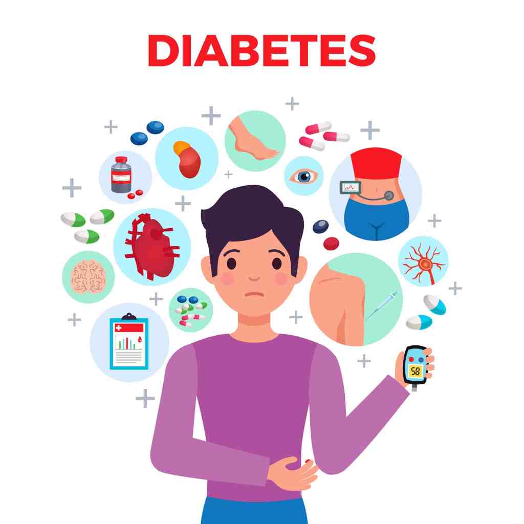 Diabetes Mellitus (Type&nbsp;2)